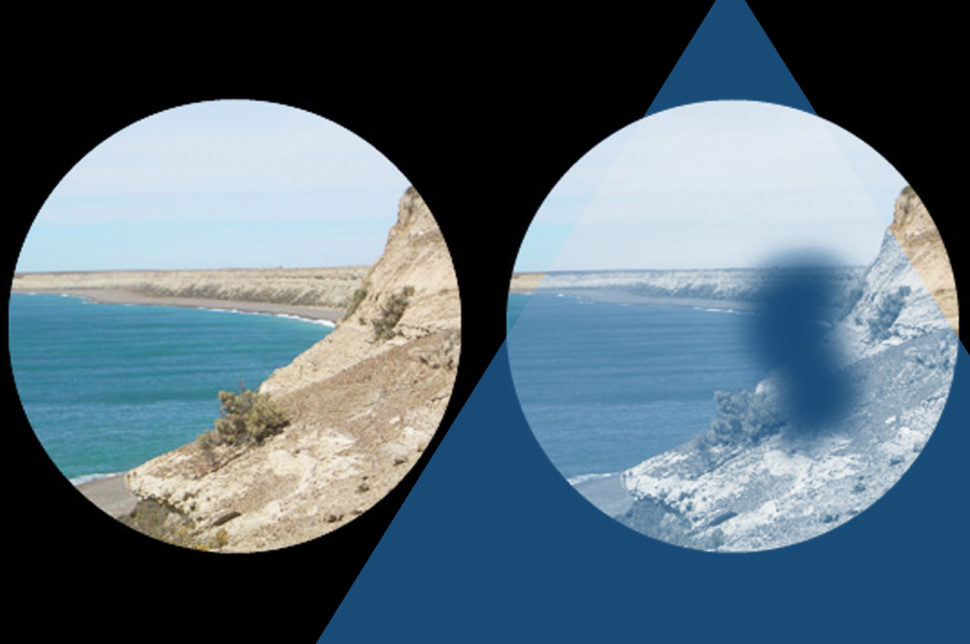 maculopatia oculistica loiodice