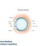 pachimetria corneale centro medico oculistico loiodice