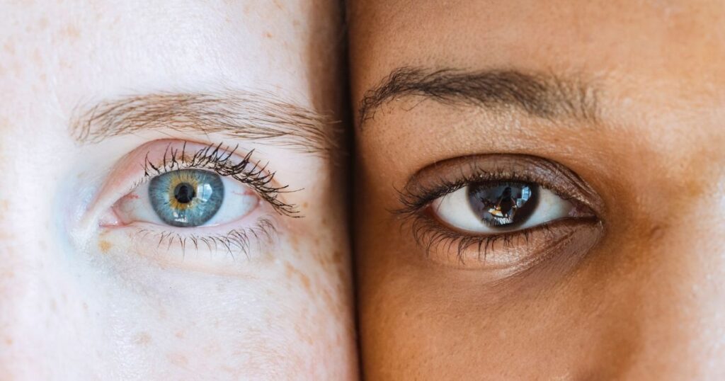 oculistica loiodice salute visiva corato