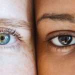 oculistica loiodice salute visiva corato